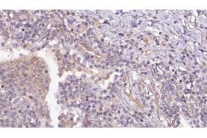 anti-RAP1B, Member of RAS Oncogene Family (RAP1B) (C-Term) antibody