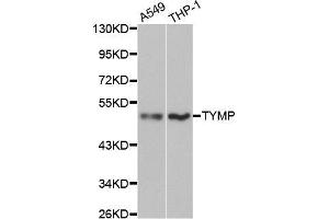 Western blot analysis of extracts of various cell lines, using TYMP antibody (ABIN5970450) at 1/1000 dilution. (Thymidine Phosphorylase anticorps)