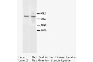 Image no. 1 for anti-BRCA1 Associated Protein-1 (Ubiquitin Carboxy-terminal Hydrolase) (BAP1) antibody (ABIN1502051) (BAP1 anticorps)