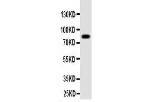 Western Blotting (WB) image for anti-Proprotein Convertase Subtilisin/kexin Type 4 (PCSK4) (AA 117-133), (N-Term) antibody (ABIN3042910) (PCSK4 anticorps  (N-Term))