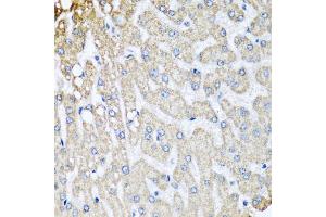 Immunohistochemistry of paraffin-embedded human liver injury using COX5B antibody.