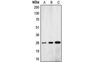 Western blot analysis of Lamin A/C expression in HeLa colchicine-treated (A), mouse liver (B), rat kidney (C) whole cell lysates. (Lamin A/C anticorps  (Center))