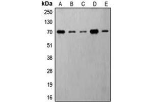 Western blot analysis of S6K1 (pT421) expression in MDAMB231 insulin-treated (A), Jurkat (B), HeLa (C), NIH3T3 (D), PC12 (E) whole cell lysates. (RPS6KB1 anticorps  (C-Term, pSer421))