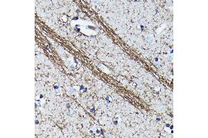 Immunohistochemistry of paraffin-embedded human brain using CNPase Rabbit mAb (ABIN7265322) at dilution of 1:100 (40x lens). (Cnpase anticorps)