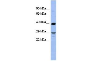 WB Suggested Anti-OLIG3 Antibody Titration:  0. (OLIG3 anticorps  (N-Term))