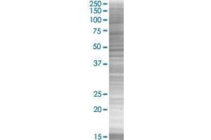 GDNF transfected lysate. (GDNF 293T Cell Transient Overexpression Lysate(Denatured))