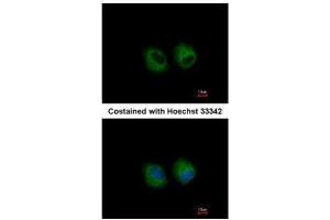 ICC/IF Image Immunofluorescence analysis of methanol-fixed A549, using IL1 Receptor 2, antibody at 1:500 dilution. (IL1R2 anticorps)