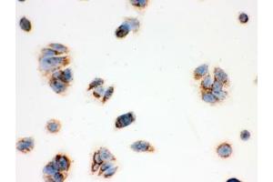 IHC testing of FFPE human MCF7 cells with ERAB antibody.