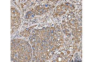 IHC analysis of SUCLG2 using anti-SUCLG2 antibody (ABIN7601694). (SUCLG2 anticorps  (AA 42-424))