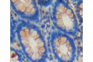 IHC-P analysis of rectum tissue, with DAB staining. (CSN2 anticorps  (AA 41-198))