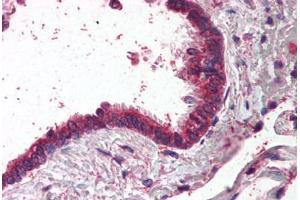 Human Lung, Respiratory Epithelium (formalin-fixed, paraffin-embedded) stained with AP1G1 antibody ABIN295688 at 2. (gamma 1 Adaptin anticorps  (AA 646-659))