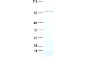 Validation with Western Blot