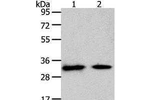 Western Blot analysis of Mouse heart and muscle tissue using SLC25A4 Polyclonal Antibody at dilution of 1:400 (SLC25A4 anticorps)