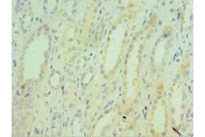 Immunohistochemistry of paraffin-embedded human kidney tissue using ABIN7171754 at dilution of 1:100 (TNXB anticorps  (AA 3933-4242))