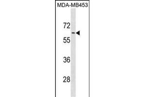 ADRA1B Antibody (C-term) (ABIN1881048 and ABIN2838875) western blot analysis in MDA-M cell line lysates (35 μg/lane). (ADRA1B anticorps  (C-Term))