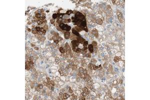 Immunohistochemical staining (Formalin-fixed paraffin-embedded sections) of human adrenal gland with FDFT1 polyclonal antibody  shows strong cytoplasmic positivity in cortical cells. (FDFT1 anticorps  (AA 10-148))