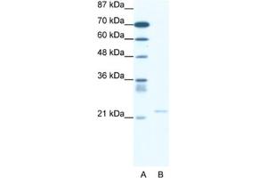 Western Blotting (WB) image for anti-Transient Receptor Potential Cation Channel, Subfamily M, Member 3 (TRPM3) antibody (ABIN2461420)