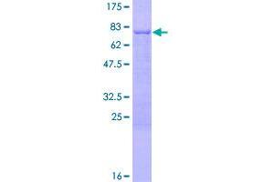 Image no. 1 for Protein Phosphatase 1F (PP2C Domain Containing) (PPM1F) (AA 1-454) protein (GST tag) (ABIN1315912)