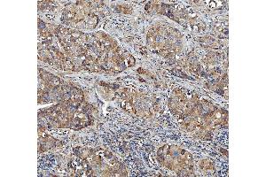 IHC analysis of Kindlin 2/FERMT2 using anti-Kindlin 2/FERMT2 antibody (ABIN7599515). (FERMT2 anticorps  (AA 1-650))