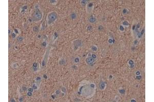 Detection of CAP2 in Human Cerebrum Tissue using Polyclonal Antibody to Adenylyl Cyclase Associated Protein 2 (CAP2)