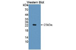 Western blot analysis of the recombinant protein. (IDO anticorps  (AA 26-199))