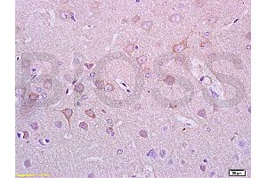 Formalin-fixed and paraffin embedded rat brain tissue with labeled Anti-Alpha-Synuclein/Syn/SNCA Polyclonal Antibody, Unconjugated (ABIN730393) at 1:200, followed by conjugation to the secondary antibody and DAB staining