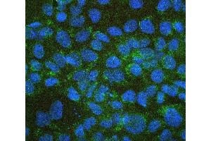 IF analysis of ALDH1A1 using anti-ALDH1A1 antibody (ABIN7602127). (ALDH1A1 anticorps  (AA 6-342))