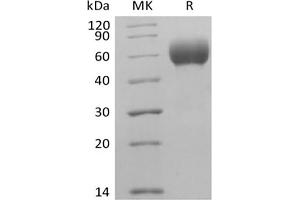 Western Blotting (WB) image for Signal-Regulatory Protein alpha (SIRPA) (Active) protein (Biotin,His-Avi Tag) (ABIN7319781)