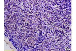 Formalin-fixed and paraffin embedded mouse colon carcinoma labeled with Anti-AMPK beta 1 Polyclonal Antibody, Unconjugated (ABIN737901) at 1:200 followed by conjugation to the secondary antibody and DAB staining.