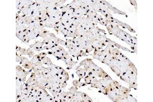 IHC analysis of Rad9/Rad9a using anti-Rad9/Rad9a antibody (ABIN7599342). (RAD9A anticorps  (AA 1-389))