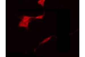 anti-NBPF1,9,10,12,14,15,16,20 antibody