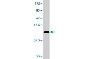 Western Blot detection against Immunogen (36. (ZNF23 anticorps  (AA 41-139))