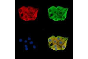 ABIN7095877 and ABIN7099939 staining Hela cells by IF/ICC. (PLA2G12B anticorps)