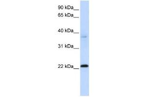 Western Blotting (WB) image for anti-Chromosome 11 Open Reading Frame 74 (C11ORF74) antibody (ABIN2459550) (C11ORF74 anticorps)