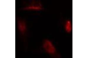 ABIN6275902 staining  A549 cells by IF/ICC. (MAD2L1 anticorps  (Internal Region))