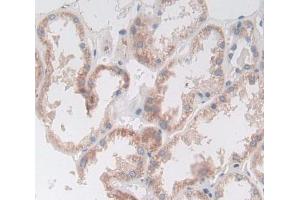 Used in DAB staining on fromalin fixed paraffin- embedded Kidney tissue (Deoxyribonuclease II (AA 19-360) anticorps)
