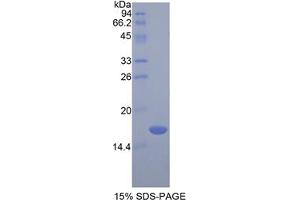 SDS-PAGE analysis of Rat Chemerin Protein.