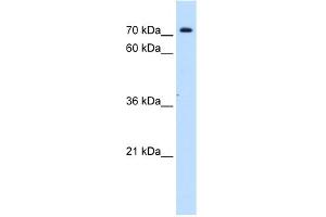WB Suggested Anti-SLC5A11 Antibody Titration:  0. (Solute Carrier Family 5 (Sodium/inositol Cotransporter), Member 11 (SLC5A11) (Middle Region) anticorps)