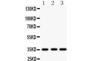 Western Blotting (WB) image for anti-Insulin-Like Growth Factor Binding Protein 2, 36kDa (IGFBP2) (AA 228-257), (C-Term) antibody (ABIN3043858) (IGFBP2 anticorps  (C-Term))