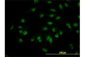 Immunofluorescence of monoclonal antibody to C1D on HeLa cell.