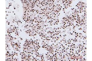 IHC analysis of NRF1 using anti-NRF1 antibody (ABIN7600874).
