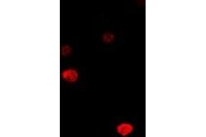 Immunofluorescent analysis of DCK staining in MCF7 cells. (DCK anticorps)