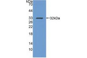 Western blot analysis of the recombinant protein. (Integrin alpha 1 anticorps  (AA 125-366))