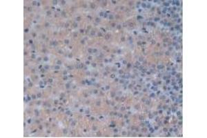 Detection of IL24 in Rat Adrenal Gland Tissue using Monoclonal Antibody to Interleukin 24 (IL24) (IL-24 anticorps  (AA 29-183))