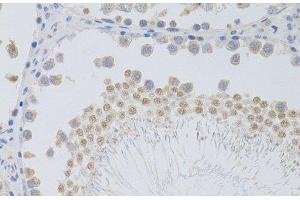 Immunohistochemistry of paraffin-embedded Rat testis using PHC1 Polyclonal Antibody at dilution of 1:100 (40x lens). (PHC1 anticorps)