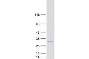 Validation with Western Blot