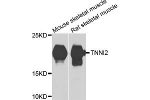 Western blot analysis of extracts of various cell lines, using TNNI2 antibody (ABIN5975229) at 1/1000 dilution. (TNNI2 anticorps)