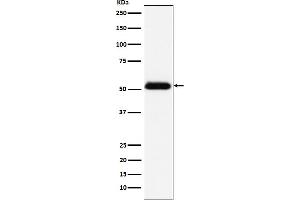 Western blot analysis of Prostatic Acid Phosphatase expression in human prostate cancer lysate.