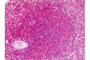 Human Spleen: Formalin-Fixed, Paraffin-Embedded (FFPE)