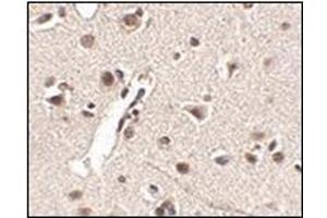 Immunohistochemistry of Rkhd4 in human brain tissue with this product at 2. (MEX3A anticorps  (C-Term))